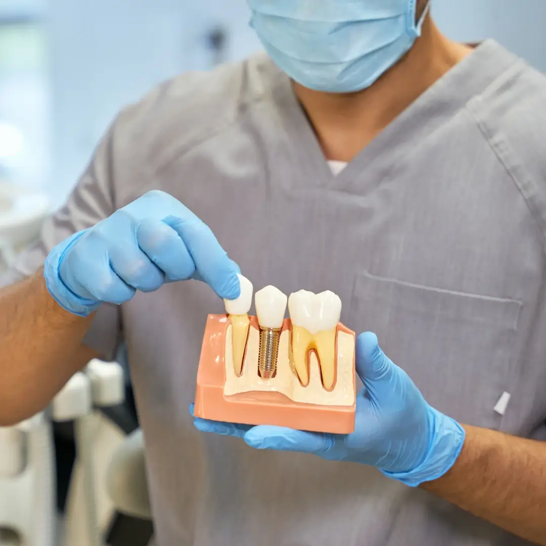 Single Tooth Implant In Mumbai | Single Tooth Implant In Mazgaon